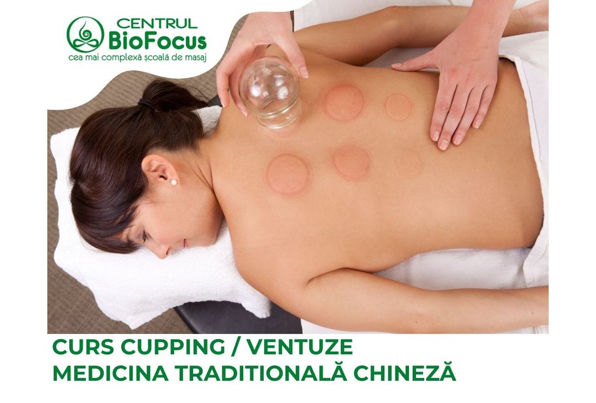 Curs Cupping (Ventuze) - Medicina Traditionala Chineza