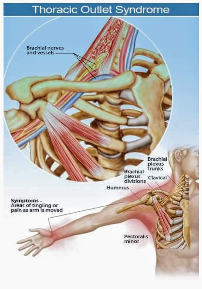 Course #6: Orthopedic Conditions Of The Upper Body & TX Protocol