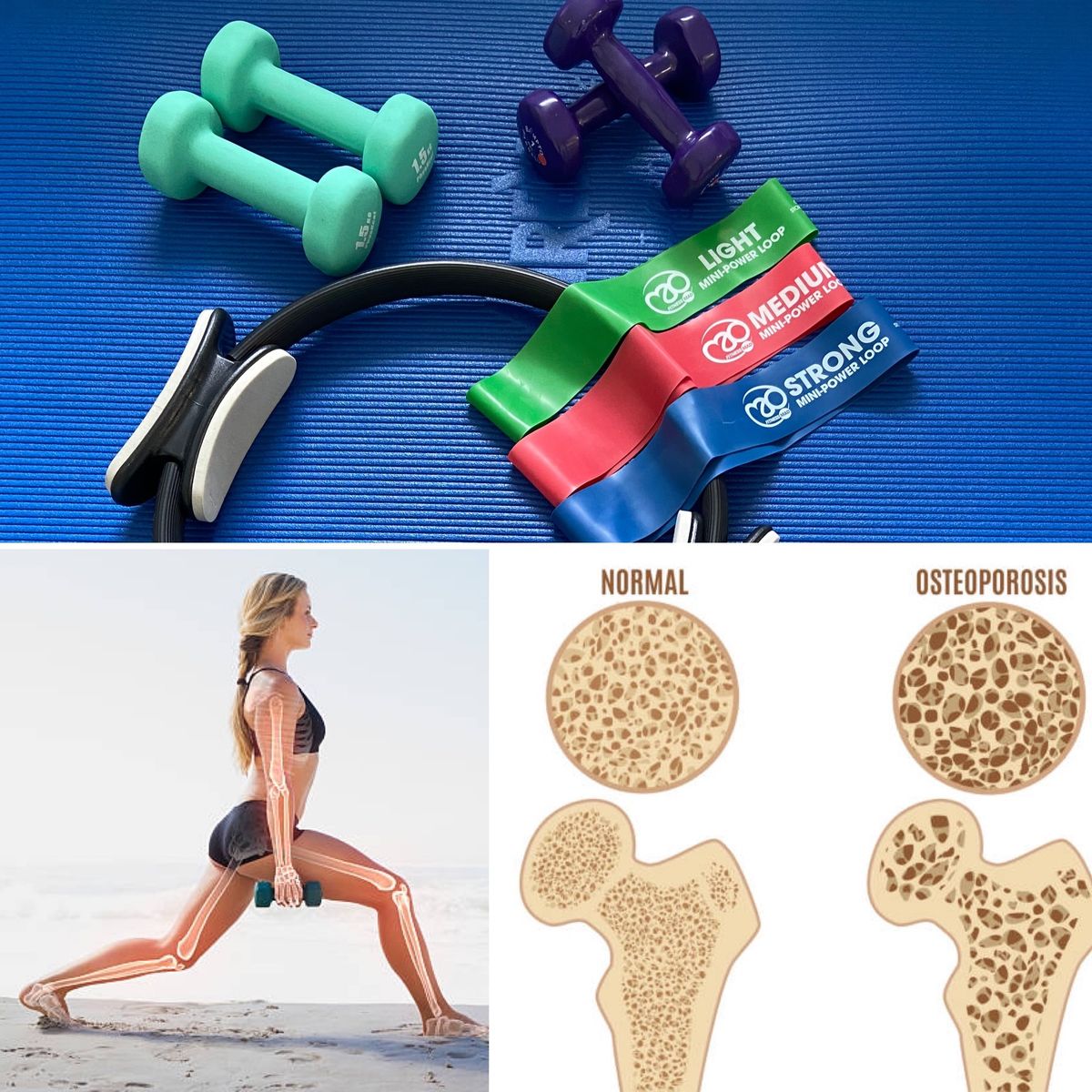 Bone Health for Osteoporosis