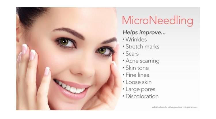 Microneedling Training Course