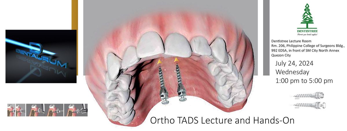 Orthodontic Temporary Anchorage Devices (TADS): Lecture and Hands-On Workshop