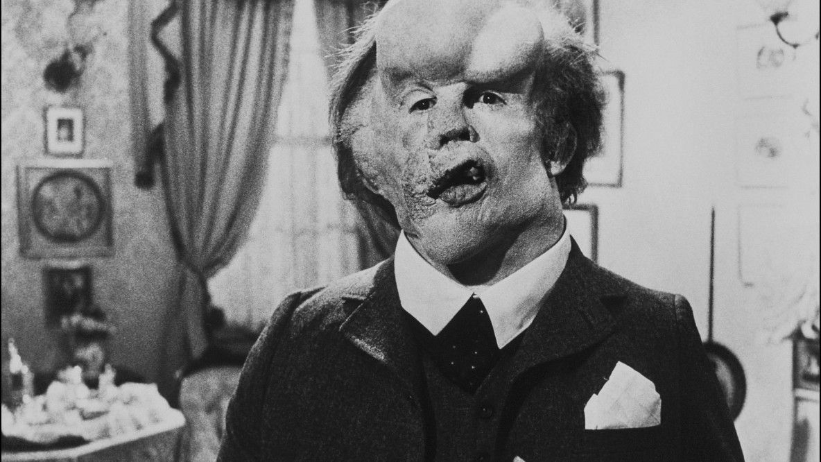 THE ELEPHANT MAN \u2022 Cine Classic mit Adrian Goiginger