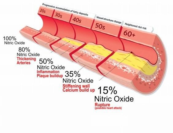 FREE Nitric Oxide Testing