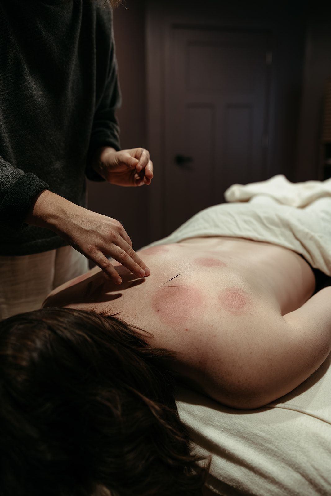 Acupuncture & Women's Health