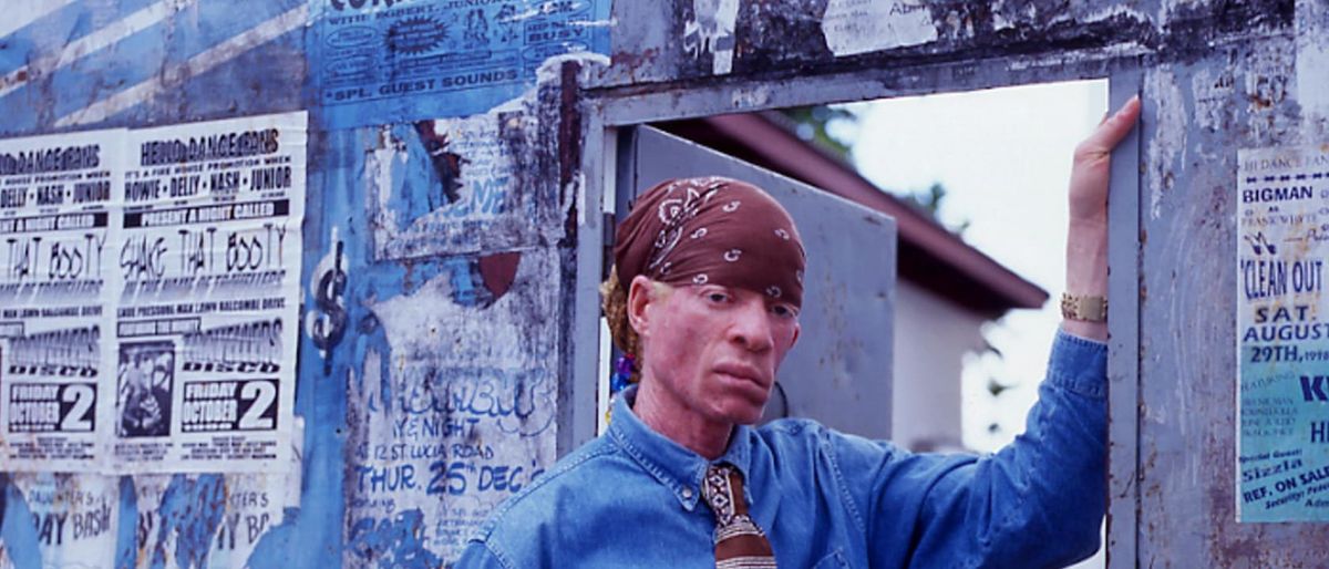 Yellowman (21+)