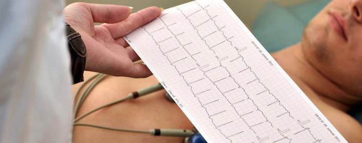 Electrocardiograf\u00eda en urgencies y emergencias