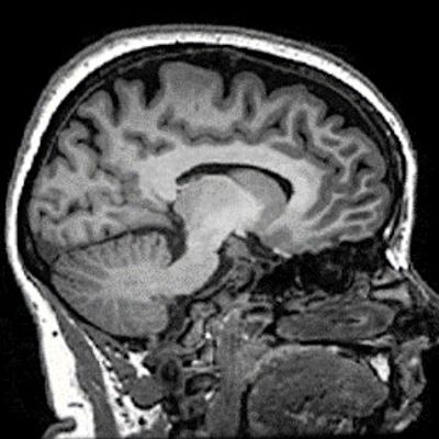 Centre for Affective Disorders