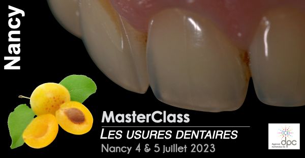 MasterClass Les Usures Dentaires