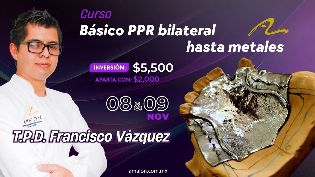 Curso Pr\u00f3tesis Parcial Removible Bilateral hasta metales