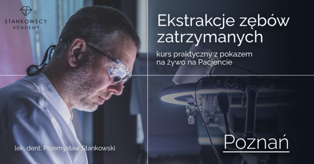 Ekstrakcje z\u0119b\u00f3w zatrzymanych - kurs praktyczny