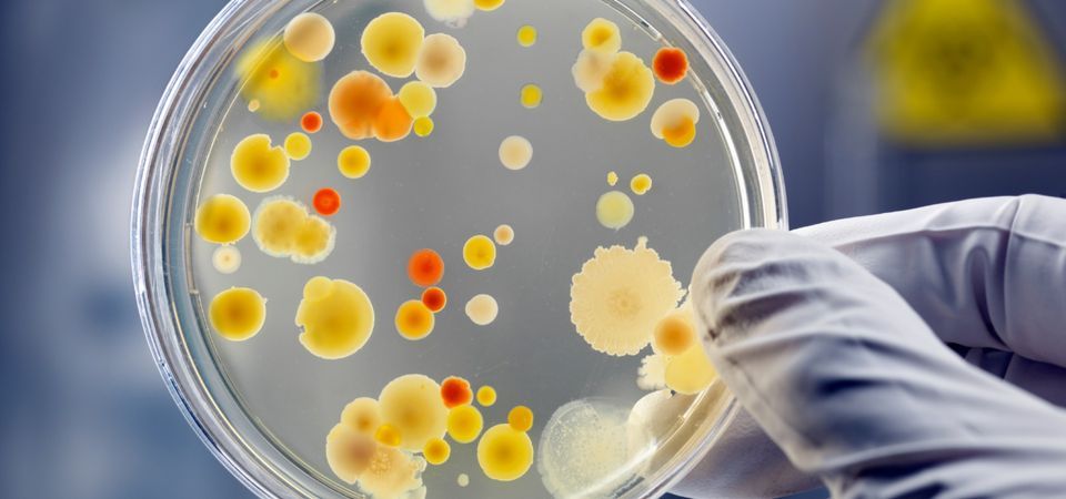 STEAM: Petri Dish Art