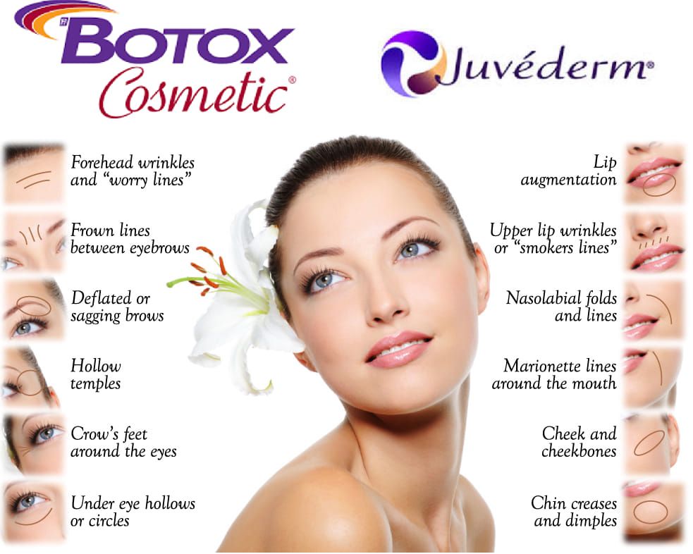 Pensacola Botox & Juv\u00e9derm Event