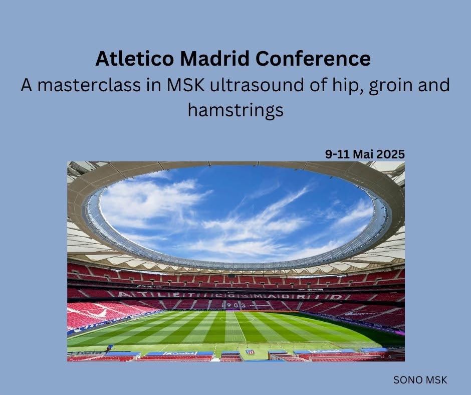 Atletico Madrid Conference