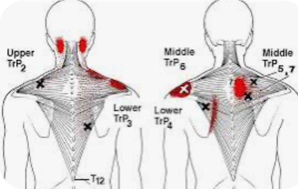 Anatomy Review, Pain Referral Pattern CEU