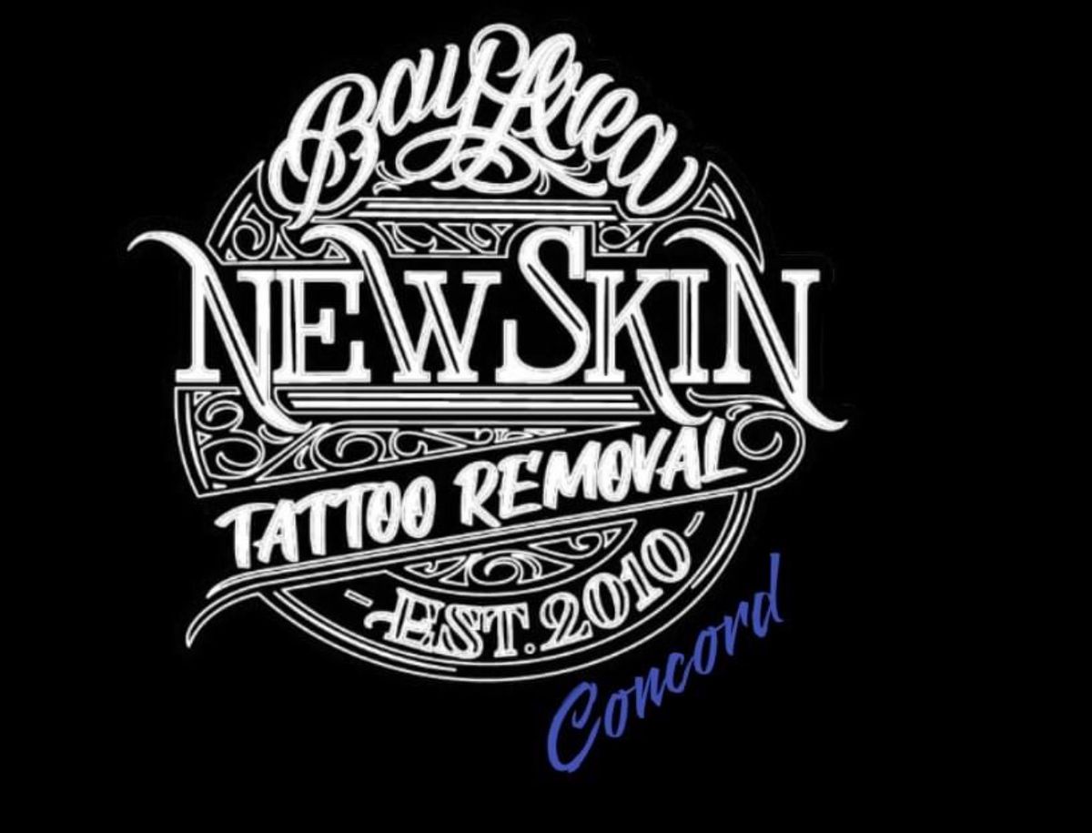 New Skin Tattoo Removal Concord 