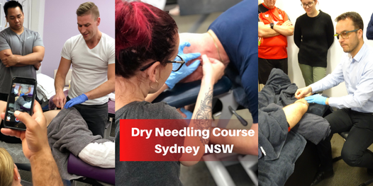 Dry Needling Course (Sydney NSW)