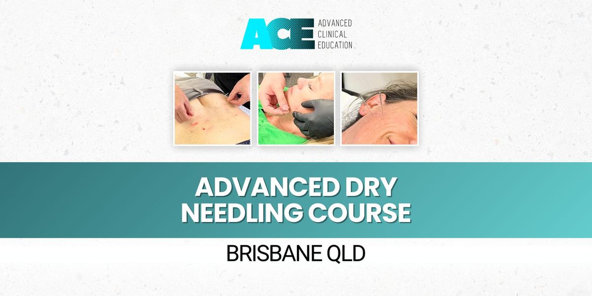 Advanced Dry Needling Course (Brisbane QLD)