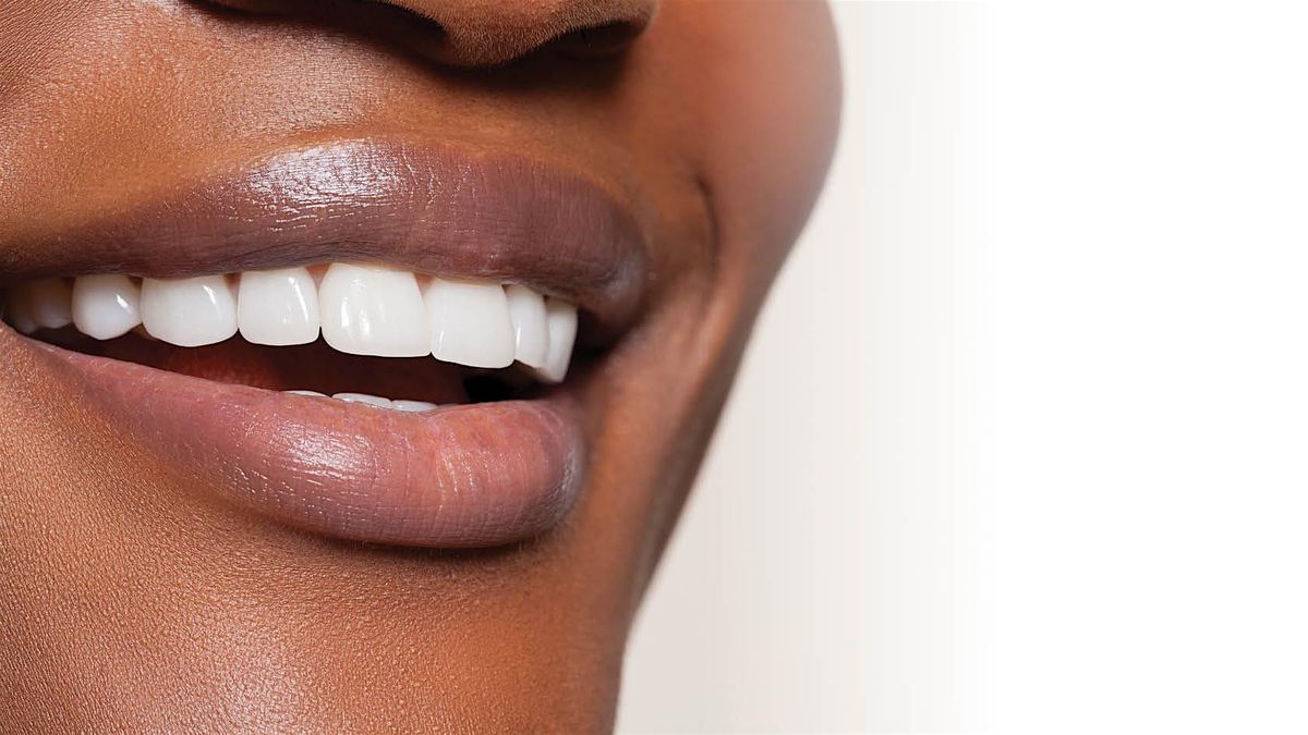 The Smile Test Drive (& Beyond), From Curiosity to Case Acceptance