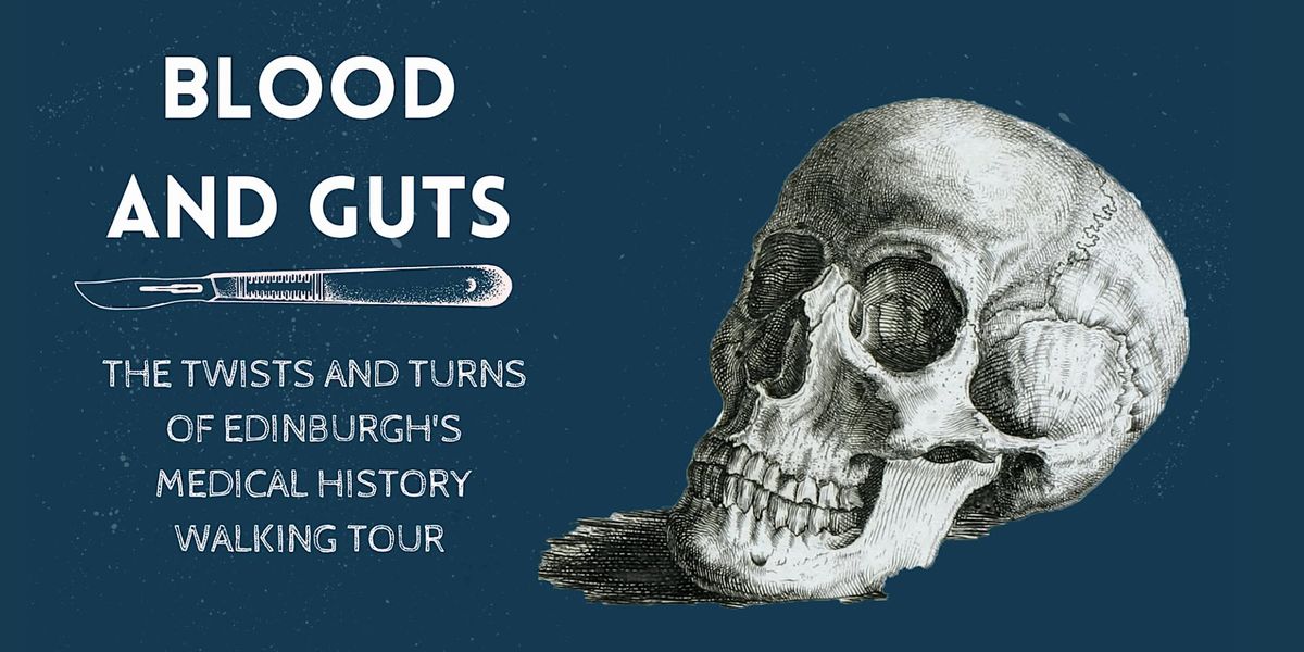 Blood and Guts: The Twists and Turns of Edinburgh's Medical History