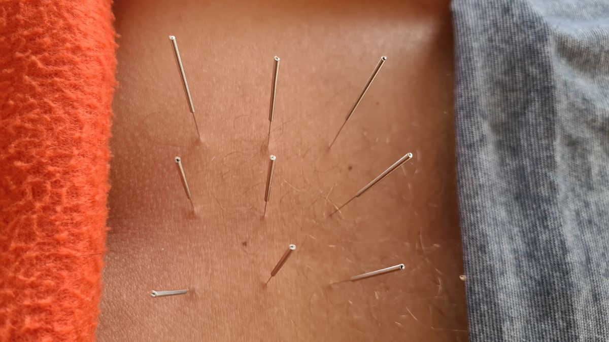 Immersion en Clinique d'Acupuncture