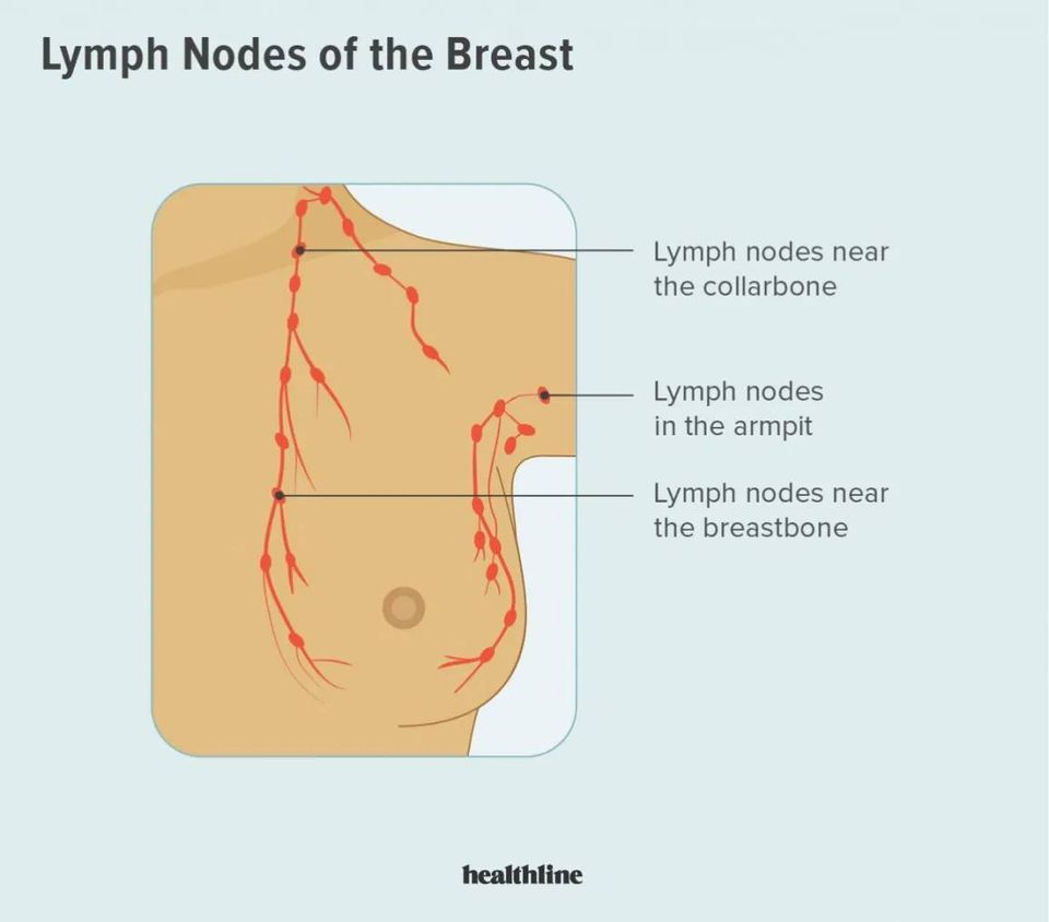 matted-axillary-lymph-nodes-breastcancer