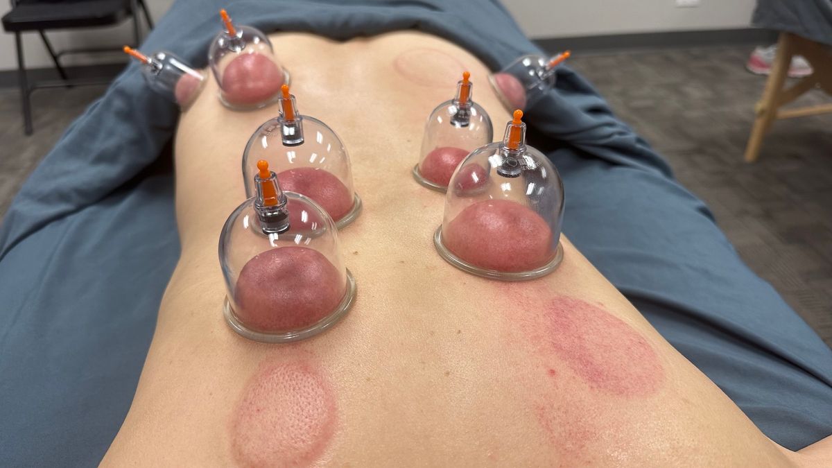 Intro To Cupping (8 CEs) 