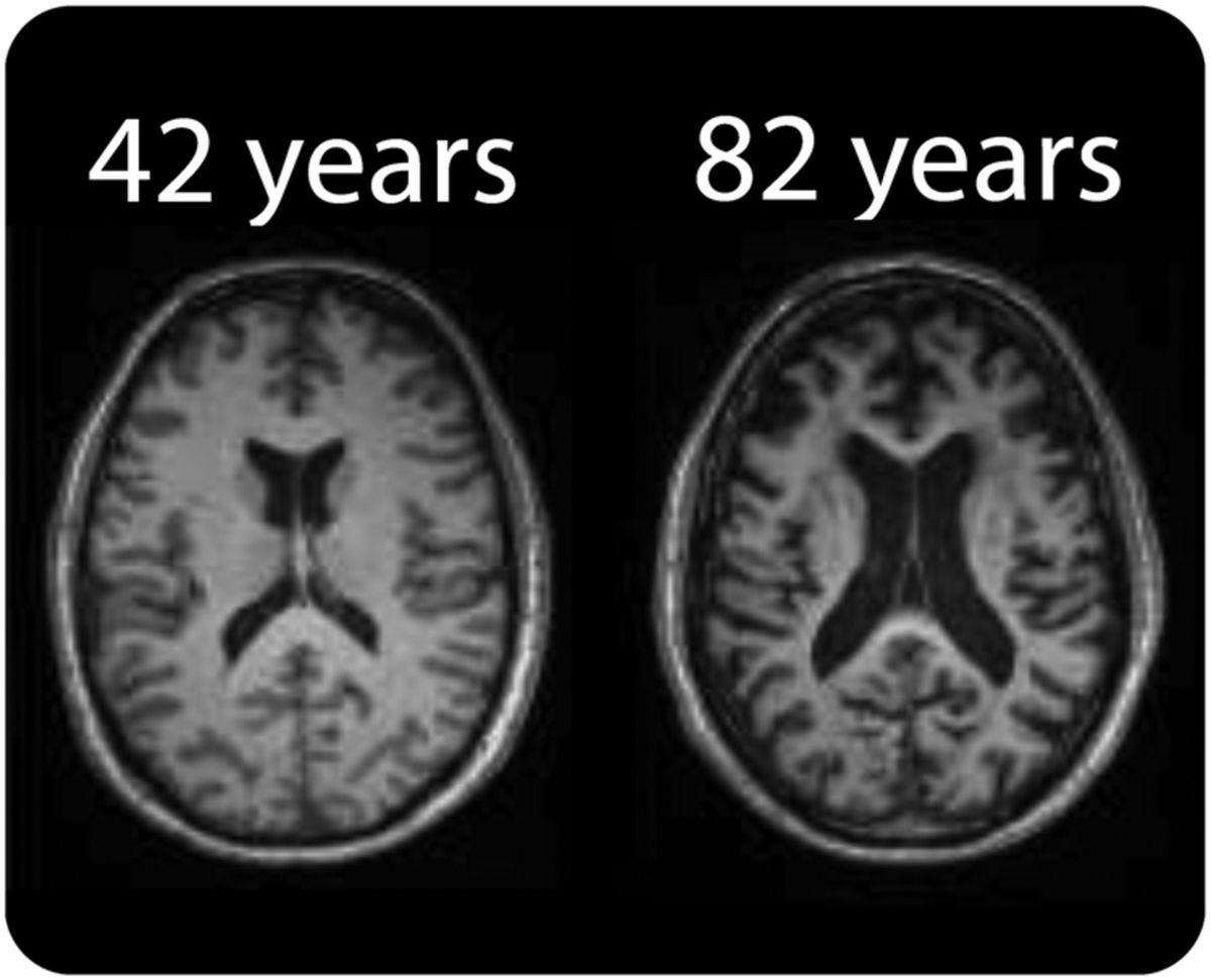 Your Aging Brain