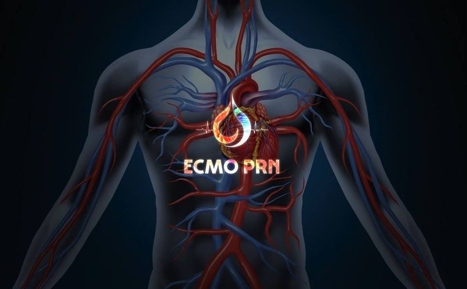 Intra-Aortic Balloon Pump