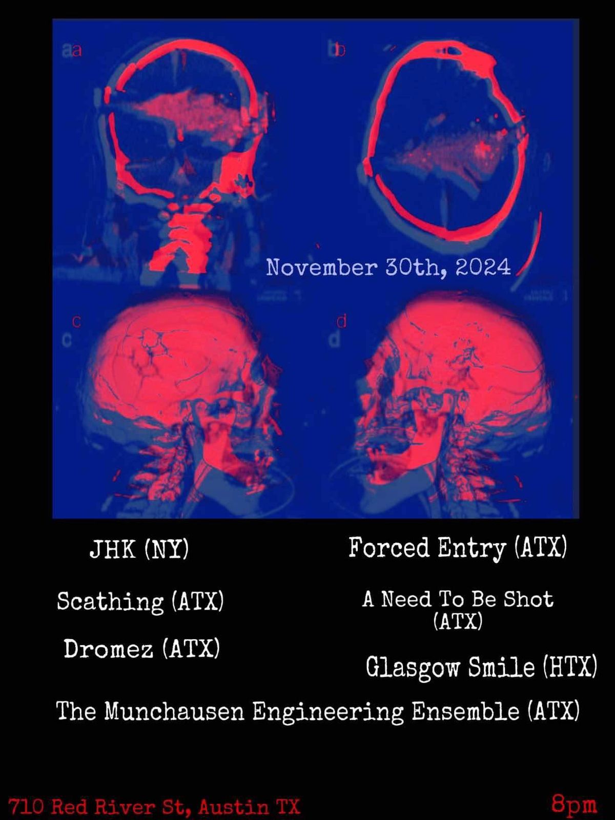 JHK,Scathing,Dromez,Munchausen Engineering Ensemble,Forced Entry,A Need to be Shot,Glasgow Smile