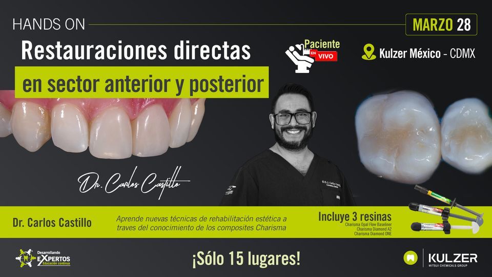 #CURSO CDMX Restauraciones directas en sector anterior y posterior??