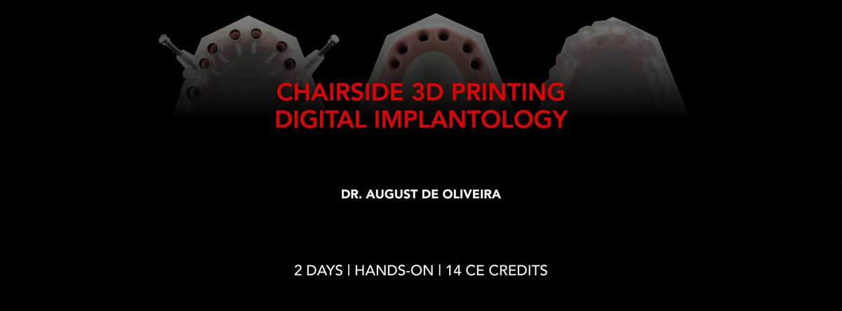 CHAIRSIDE 3D PRINTING - DIGITAL IMPLANTOLOGY