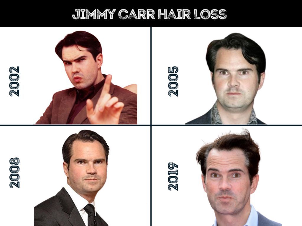 Jimmy Carr