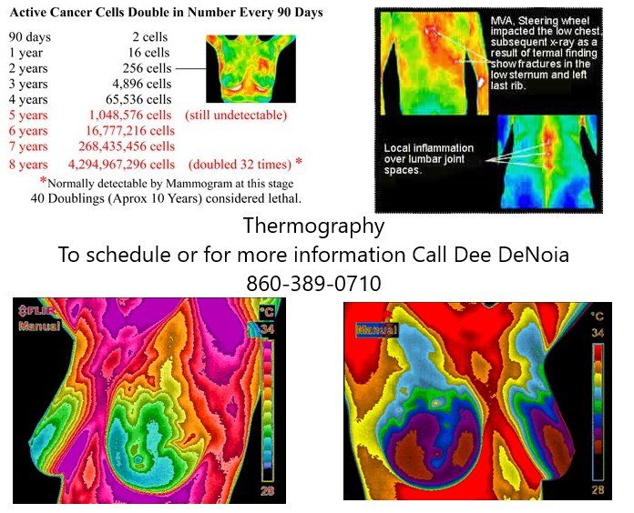 Thermography