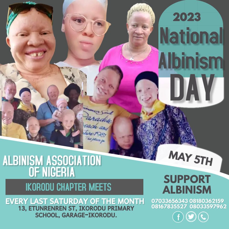 NATIONAL ALBINISM DAY