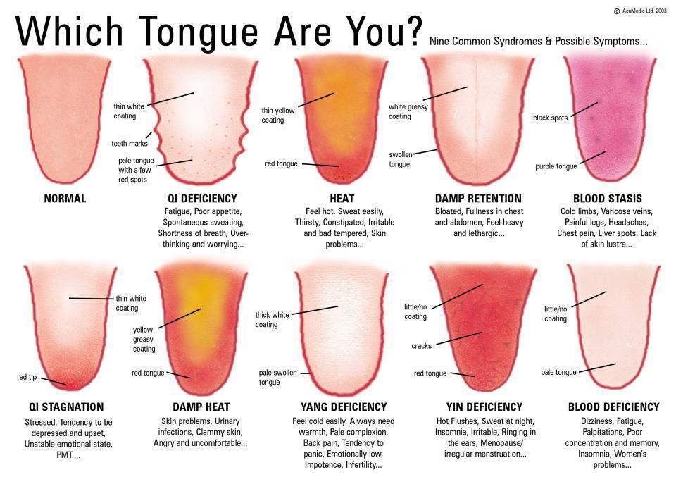Understanding Tongue and Pulse Diagnostics