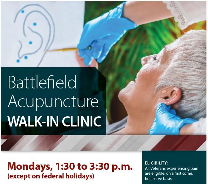 Walk-in Battlefield Acupuncture at Rocky Mountain Regional 