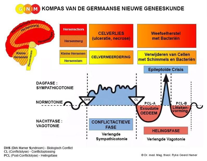 Workshop\/lezing "Jouw persoonlijke Ziekte begrijpen (vanuit GNM\/Natuurwetten)"