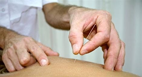 Introduction to Dry Needling - CPD