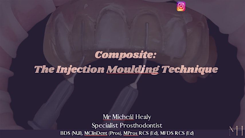 Composite - The Injection Moulding Technique