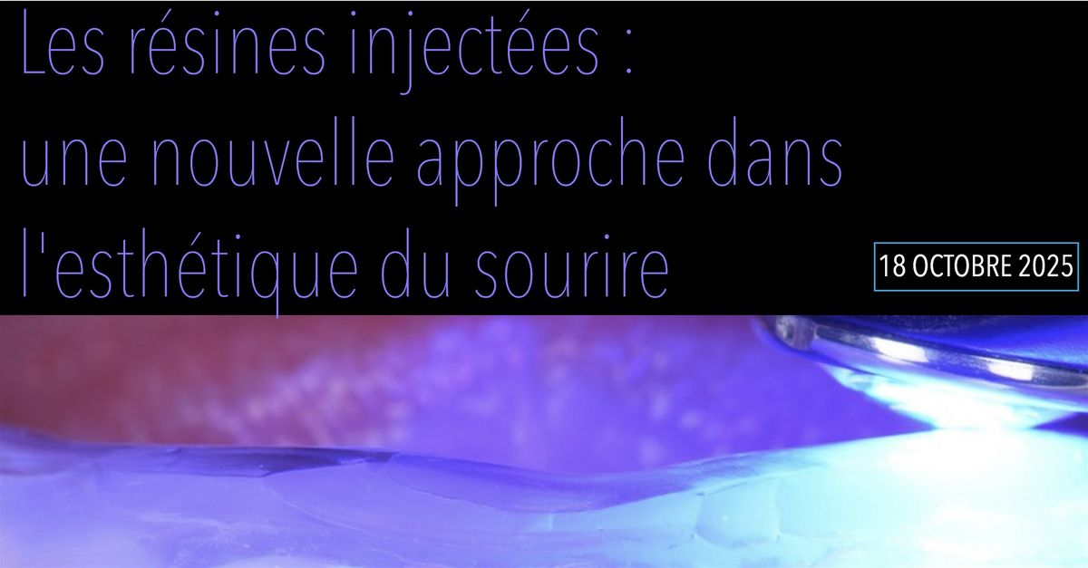 Les r\u00e9sines composites inject\u00e9es, une nouvelle approche dans l'esth\u00e9tique du sourire