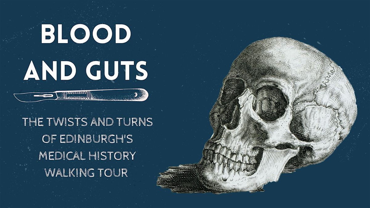 Blood and Guts: The Twists and Turns of Edinburgh's Medical History