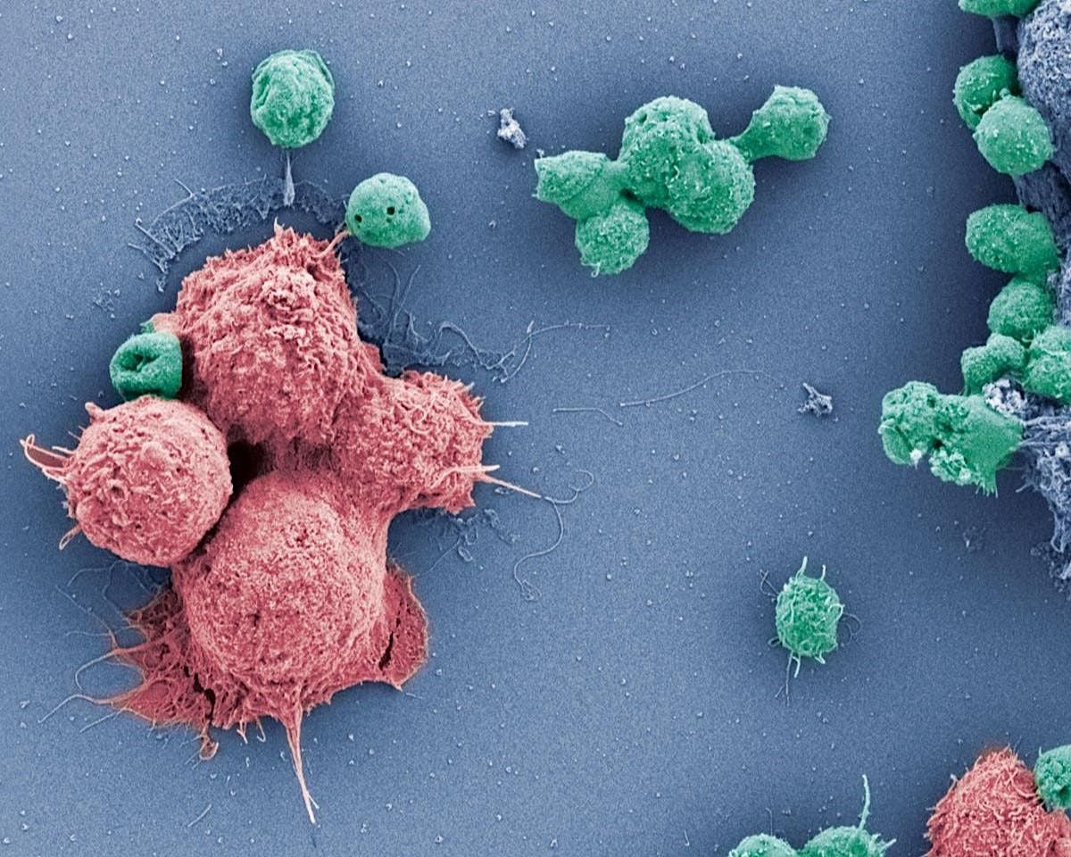 Cancer Immunotherapy: From Bench to Bedside and Back