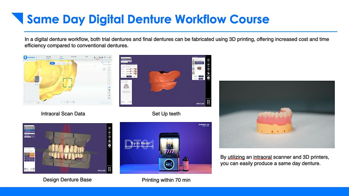 Same Day Digital Dentures - Clinical Workflow Training