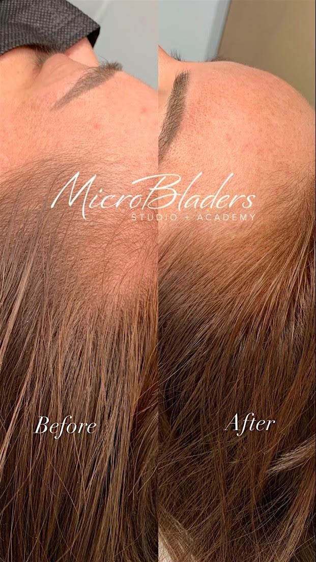 MicroBladers' Las Vegas Machine Hairline Restoration Training Workshop