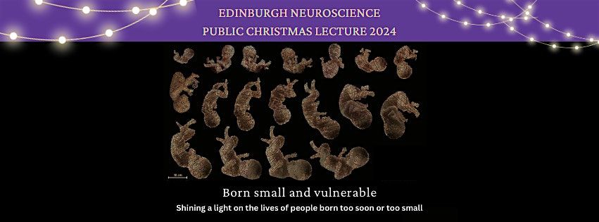 Edinburgh Neuroscience Annual Public Christmas Lecture