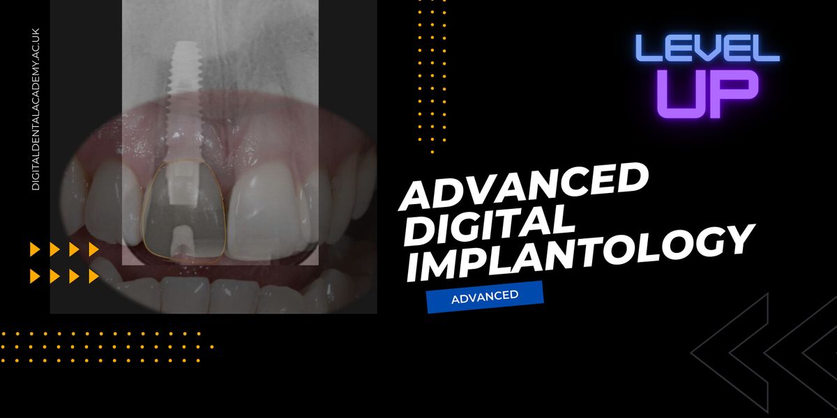 ADVANCED Digital  Implantology