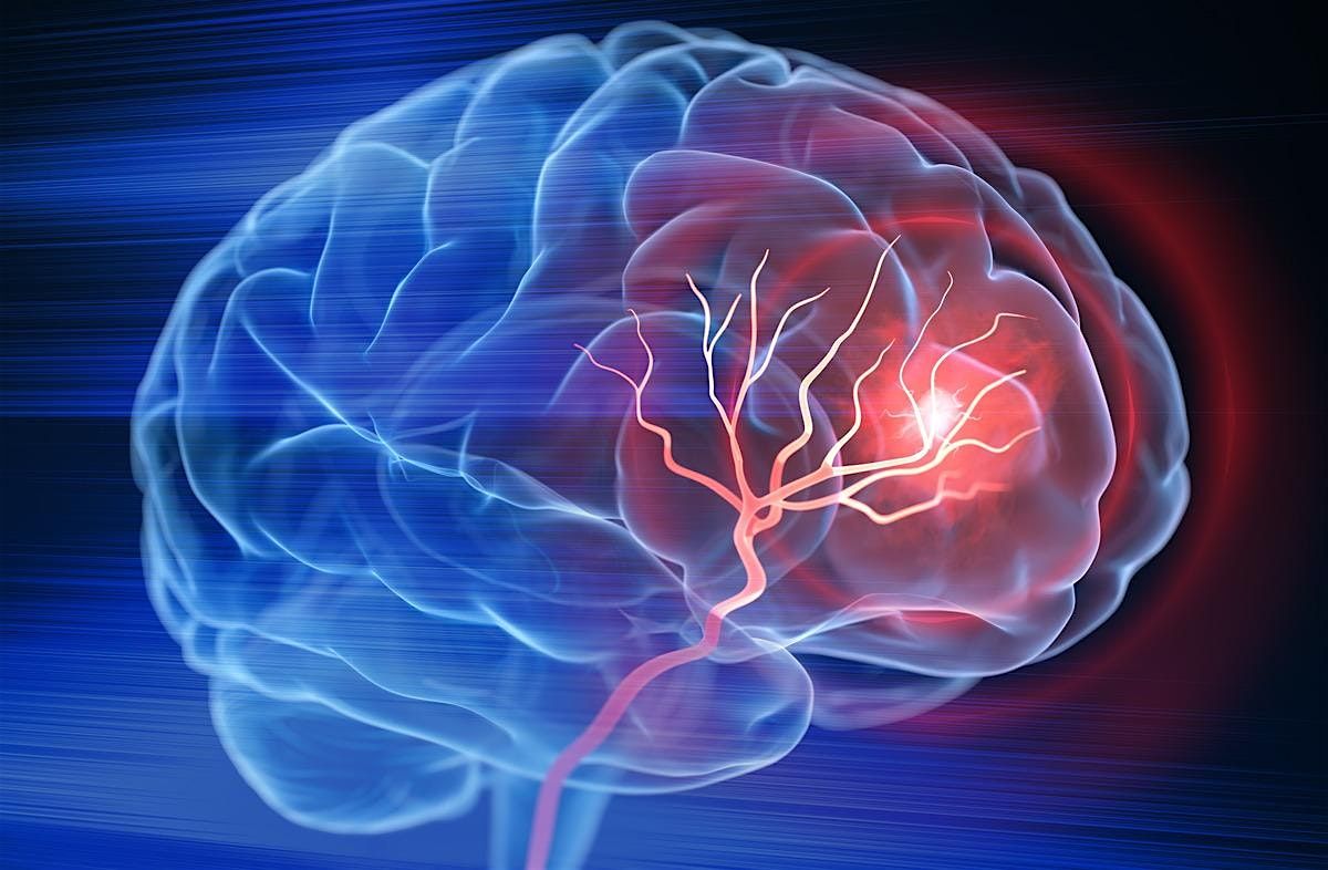 Tips and Pearls for EMS When Assessing a Possible Acute Ischemic Stroke