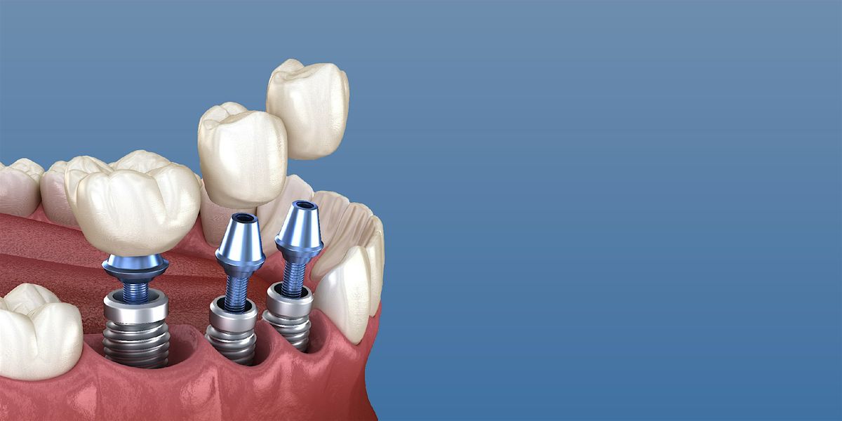 Implant Re-Rehabilitation: The Operative Sequences For A Successful Outcome
