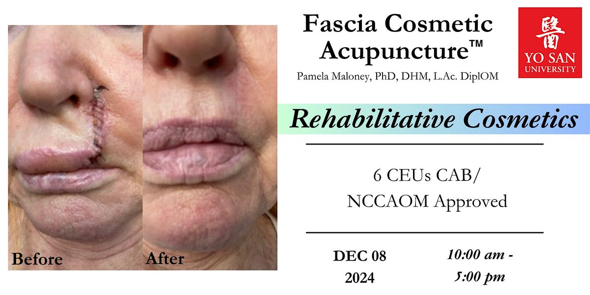 Rehabilitative Fascia Cosmetic Acupuncture\u2122