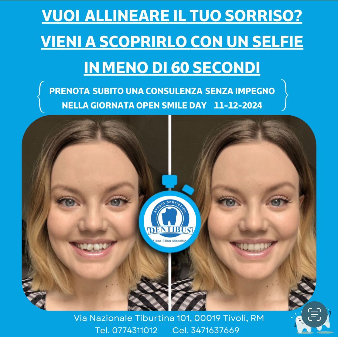 SIMULAZIONE DEL TUO NUOVO SORRISO!